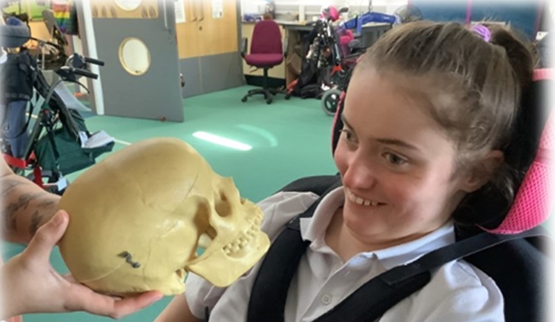 Treloar's student being shown a skull